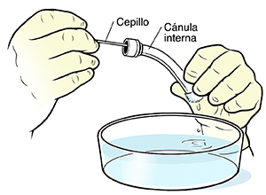 Primer plano de manos empujando un cepillo de limpieza a través de una cánula de traqueostomía sobre un recipiente con agua.