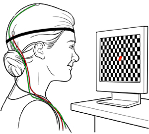 Mujer con electrodos en la cabeza observando un tablero de damas en una pantalla durante una prueba de potenciales provocados.