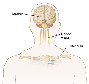 Vista frontal de la cabeza y el tórax de un hombre donde se observan el cerebro y los nervios vagos.
