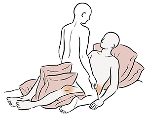 Posición sexual cara a cara en la que una persona está recostada con almohadas debajo y entre las rodillas. La otra persona está tendida encima a horcajadas. 