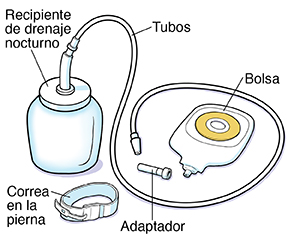 Partes de un sistema de drenaje nocturno.